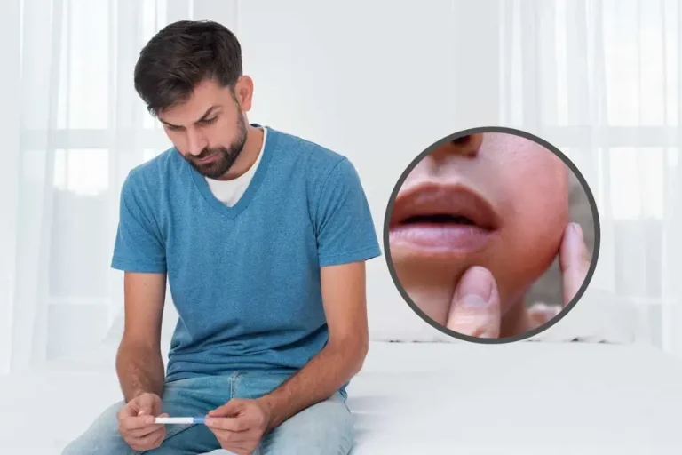 Can Mumps Cause Infertility in Males